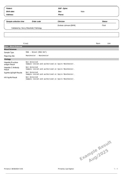 HIV Viral Load