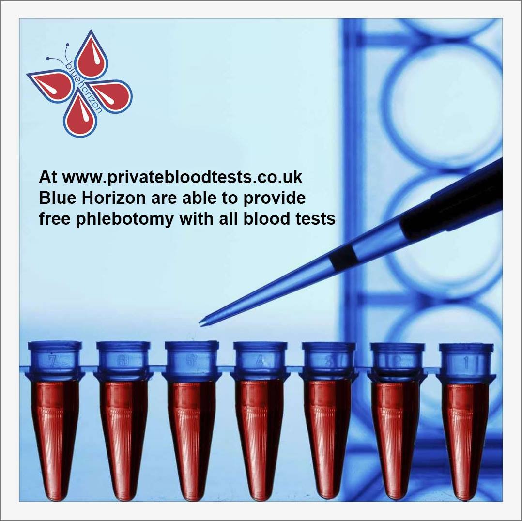 Deoxypyridinoline (serum) blood test